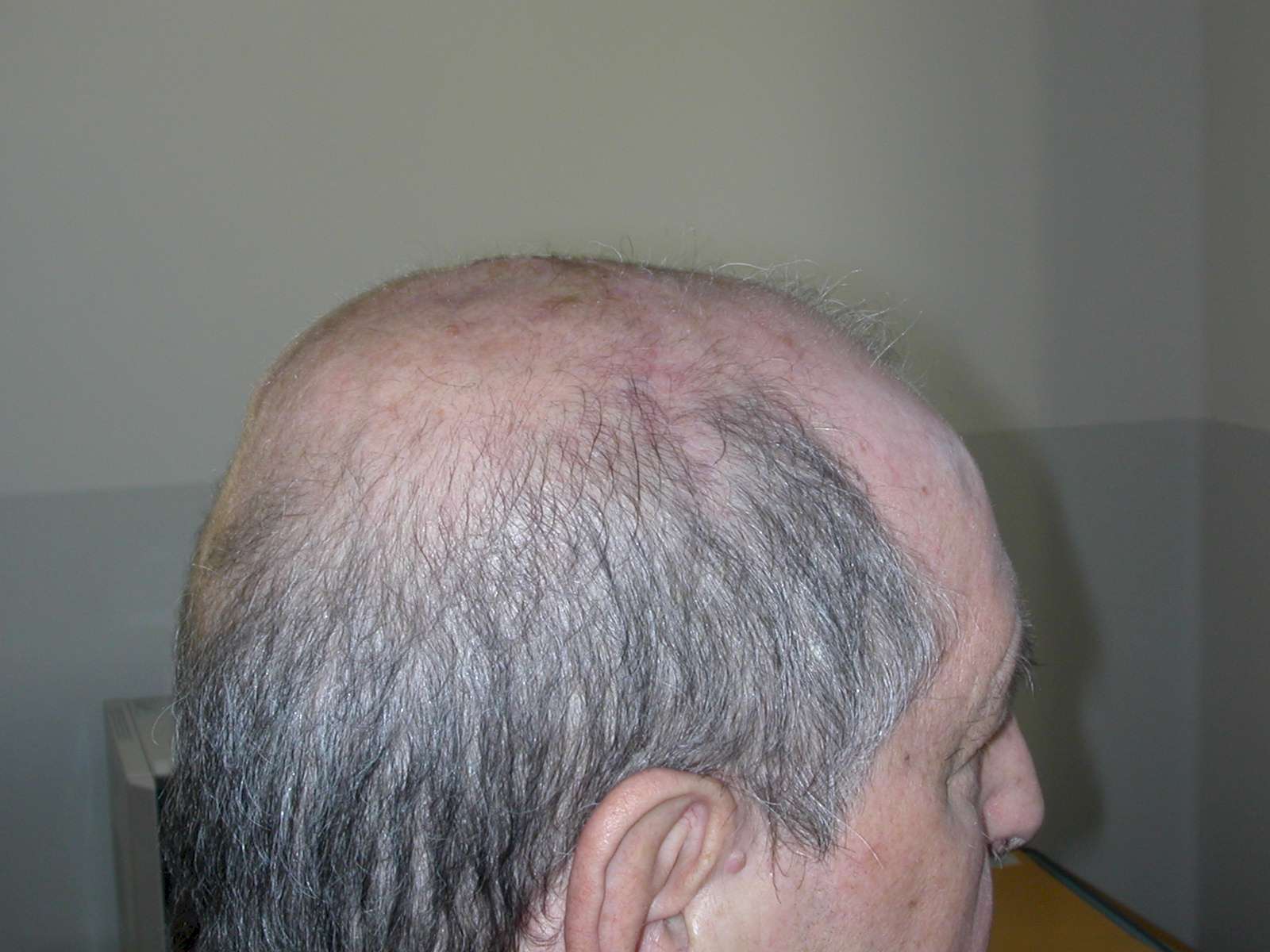 Cranioplastica new MAGAZINE