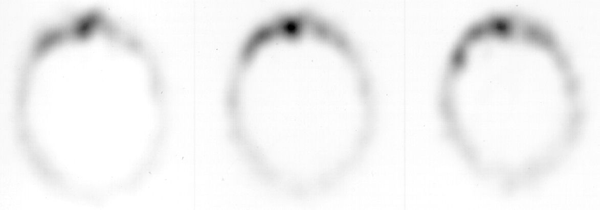 Cranioplastica new MAGAZINE